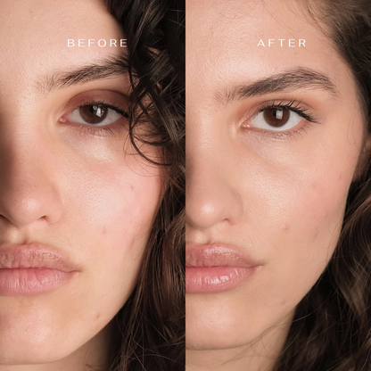 Celemi Cosmetics - Intensively moisturizing face and neck serum